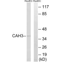 Western blot analysis of extracts from HUVEC cells, using CA3 antibody.