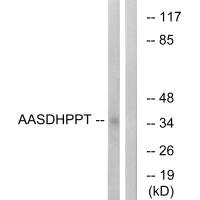 Western blot analysis of extracts from COLO cells, using AASDHPPT antibody.
