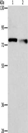 Gel: 10%SDS-PAGE, Lysate: 40 ug, Lane 1-2: A549 cells, 231 cells, Primary antibody: CSB-PA299370(NEK11 Antibody) at dilution 1/1000, Secondary antibody: Goat anti rabbit IgG at 1/8000 dilution, Exposure time: 1 minute