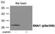 Western blot analysis of extracts from Rat heart tissue using SNAI1 (Phospho-Ser246) Antibody Antibody.The lane on the right is treated with the antigen-specific peptide.