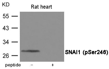 Western blot analysis of extracts from Rat heart tissue using SNAI1 (Phospho-Ser246) Antibody Antibody.The lane on the right is treated with the antigen-specific peptide.