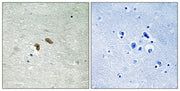 Immunohistochemical analysis of paraffin-embedded human brain tissue using C-RAF (Phospho-Thr269) antibody (left)or the same antibody preincubated with blocking peptide (right).