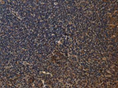 The image on the left is immunohistochemistry of paraffin-embedded Human tonsil tissue using CSB-PA299855(CYBA Antibody) at dilution 1/20, on the right is treated with synthetic peptide. (Original magnification: ×200)