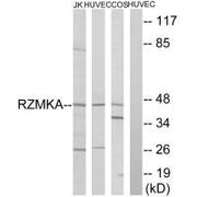 Western blot analysis of extracts from Jurkat cells, HuvEc cells and COS cells, using RIMKA antibody.