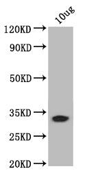 Western Blot Positive WB detected in: recombinant protein All lanes: bamB Antibody at 1:1000 Secondary Goat polyclonal to rabbit IgG at 1/50000 dilution Predicted band size: 31 kDa Observed band size: 31 kDa