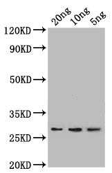 Western Blot Positive WB detected in: recombinant protein All lanes: lpp Antibody at 1:1000 Secondary Goat polyclonal to rabbit IgG at 1/50000 dilution Predicted band size: 24 kDa Observed band size: 27 kDa