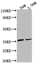 Western Blot Positive WB detected in Recombinant protein All lanes: D antibody at 1:2000 Secondary Goat polyclonal to rabbit IgG at 1/50000 dilution Predicted band size: 32.4 kDa Observed band size: 35 kDa