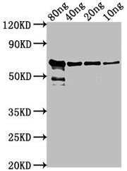 Western Blot Positive WB detected in Recombinant protein All lanes: VP2 antibody at 1:2000 Secondary Goat polyclonal to rabbit IgG at 1/50000 dilution Predicted band size: 62 kDa Observed band size: 62 kDa