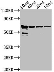 Western Blot Positive WB detected in Recombinant protein All lanes: VP2 antibody at 1:2000 Secondary Goat polyclonal to rabbit IgG at 1/50000 dilution Predicted band size: 62 kDa Observed band size: 62 kDa