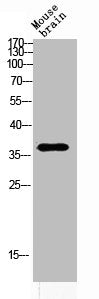Western blot analysis of MOUSE-BRAIN lysis using ART1 antibody. Antibody was diluted at 1:2000. Secondary antibody was diluted at 1:20000