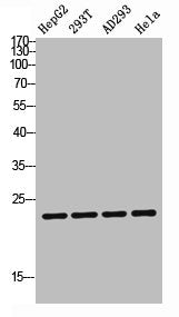 Western blot analysis of HepG2 293T AD293 Hela lysis using TDGF1P3 antibody. Antibody was diluted at 1:1000. Secondary antibody was diluted at 1:20000