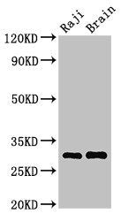 Western Blot Positive WB detected in: Raji whole cell lysate, Mouse brain tissue All lanes: HLA-DRB3 antibody at 3.5µg/ml Secondary Goat polyclonal to rabbit IgG at 1/50000 dilution Predicted band size: 30 kDa Observed band size: 30 kDa