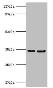 Western blot All lanes: P antibody at 2µg/ml Lane 1: Rabies virus Phosphoprotein protein at 1µg Lane 2: Rabies virus Phosphoprotein protein at 0.1µg Secondary Goat polyclonal to rabbit IgG at 1/10000 dilution Predicted band size: 34, 32, 28, 26, 2...