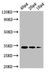 Western Blot Positive WB detected in: Rosseta bacteria lysate at 40ug, 20ug, 10ug All lanes: ldcA antibody at 1ug/ml Secondary Goat polyclonal to rabbit IgG at 1/50000 dilution predicted band size: 34 kDa observed band size: 34 kDa