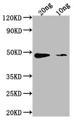 Western Blot Positive WB detected in Recombinant protein All lanes: aur antibody at 1:2000 Secondary Goat polyclonal to rabbit IgG at 1/50000 dilution Predicted band size: 39.3 kDa Observed band size: 50 kDa