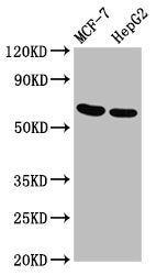 Western Blot Positive WB detected in: MCF-7 whole cell lysate, HepG2 whole cell lysate All lanes: GNAS antibody at 3.4µg/ml Secondary Goat polyclonal to rabbit IgG at 1/50000 dilution Predicted band size: 68 kDa Observed band size: 68 kDa