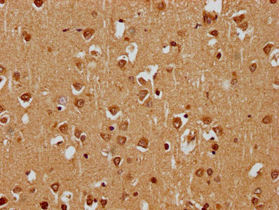 IHC image of CSB-PA308064HA01HU diluted at 1:400 and staining in paraffin-embedded human brain tissue performed on a Leica BondTM system. After dewaxing and hydration, antigen retrieval was mediated by high pressure in a citrate buffer (pH 6.0). S...