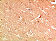 Immunohistochemical analysis of paraffin-embedded Human Skeletal Muscle Tissue using ATG13 Rabbit pAb diluted at 1:200