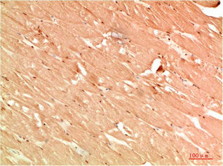 Immunohistochemical analysis of paraffin-embedded Human Skeletal Muscle Tissue using ATG13 Rabbit pAb diluted at 1:200