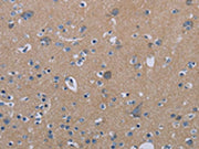 The image on the left is immunohistochemistry of paraffin-embedded Human brain tissue using CSB-PA309418(PDE4D Antibody) at dilution 1/20, on the right is treated with synthetic peptide. (Original magnification: ×200)