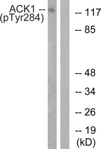 Western blot analysis of extracts from HepG2 cells treated with EGF using ACK1 (Phospho-Tyr284) Antibody.The lane on the right is treated with the antigen-specific peptide.
