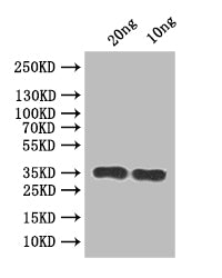 Western Blot Positive WB detected in: recombinant protein All lanes:RSC2 Antibody at 1:1000 Secondary Goat polyclonal to rabbit IgG at 1/50000 dilution Predicted band size: 32 kDa Observed band size: 35 kDa