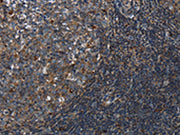The image on the left is immunohistochemistry of paraffin-embedded Human tonsil tissue using CSB-PA313669(LAIR2 Antibody) at dilution 1/20, on the right is treated with synthetic peptide. (Original magnification: ×200)