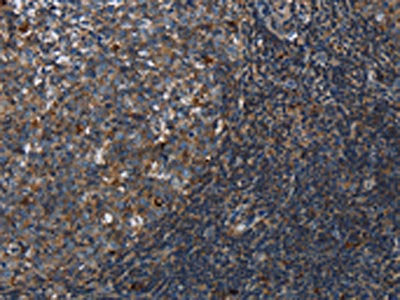 The image on the left is immunohistochemistry of paraffin-embedded Human tonsil tissue using CSB-PA313669(LAIR2 Antibody) at dilution 1/20, on the right is treated with synthetic peptide. (Original magnification: ×200)