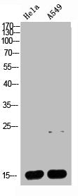Western blot analysis of HELA A549 Cell Lysate, antibody was diluted at 1:1000