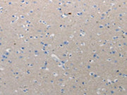 The image on the left is immunohistochemistry of paraffin-embedded Human urinary bladder tissue using CSB-PA313736(CMTM1 Antibody) at dilution 1/10, on the right is treated with synthetic peptide. (Original magnification: ×200)