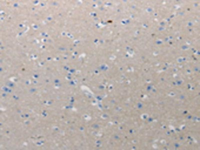 The image on the left is immunohistochemistry of paraffin-embedded Human urinary bladder tissue using CSB-PA313736(CMTM1 Antibody) at dilution 1/10, on the right is treated with synthetic peptide. (Original magnification: ×200)
