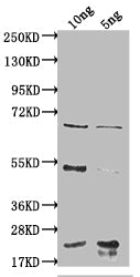 Western Blot Positive WB detected in Recombinant protein All lanes: degP antibody at 1:2000 Secondary Goat polyclonal to rabbit IgG at 1/50000 dilution Predicted band size: 62.8 kDa Observed band size: 65 kDa