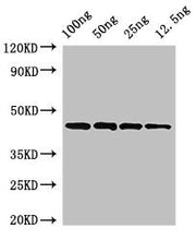 Western Blot Positive WB detected in Recombinant protein All lanes: speB antibody at 3.2µg/ml Secondary Goat polyclonal to rabbit IgG at 1/50000 dilution Predicted band size: 44 kDa Observed band size: 44 kDa
