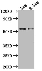 Western Blot Positive WB detected in Recombinant protein All lanes: GAG antibody at 1:2000 Secondary Goat polyclonal to rabbit IgG at 1/50000 dilution Predicted band size: 52.2 kDa Observed band size: 51 kDa