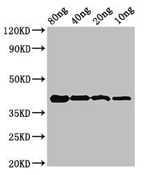 Western Blot Positive WB detected in Recombinant protein All lanes: omcB antibody at 3.2µg/ml Secondary Goat polyclonal to rabbit IgG at 1/50000 dilution Predicted band size: 42 kDa Observed band size: 42 kDa