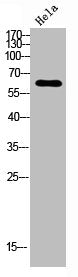 Western blot analysis of Hela using Endoglycan antibody.. Secondary antibody was diluted at 1:20000
