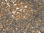 The image on the left is immunohistochemistry of paraffin-embedded Human tonsil tissue using CSB-PA316150(STAB1 Antibody) at dilution 1/20, on the right is treated with synthetic peptide. (Original magnification: ×200)