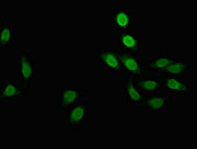 Immunofluorescent analysis of A549 cells using CSB-PA316685LA01HU at dilution of 1:100 and Alexa Fluor 488-congugated AffiniPure Goat Anti-Rabbit IgG(H+L)