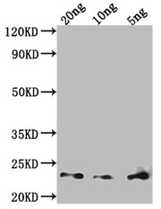 Western Blot Positive WB detected in Recombinant protein All lanes: Major mite allergen Der p 23 antibody at 1:2000 Secondary Goat polyclonal to rabbit IgG at 1/50000 dilution Predicted band size: 20 kDa Observed band size: 23 kDa
