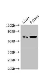 Western Blot Positive WB detected in: Rat liver tissue, Rat spleen tissue All lanes: PRSS56 antibody at 3µg/ml Secondary Goat polyclonal to rabbit IgG at 1/50000 dilution Predicted band size: 65 kDa Observed band size: 65 kDa