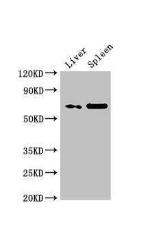 Western Blot Positive WB detected in: Rat liver tissue, Rat spleen tissue All lanes: PRSS56 antibody at 3µg/ml Secondary Goat polyclonal to rabbit IgG at 1/50000 dilution Predicted band size: 65 kDa Observed band size: 65 kDa