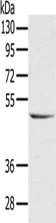 Gel: 8%SDS-PAGE, Lysate: 40 ug, Lane: Raji cells, Primary antibody: CSB-PA318480(CYTH1 Antibody) at dilution 1/200, Secondary antibody: Goat anti rabbit IgG at 1/8000 dilution, Exposure time: 10 seconds