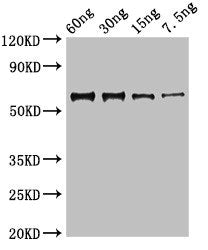 Western Blot Positive WB detected in Recombinant protein All lanes: N antibody at 3µg/ml Secondary Goat polyclonal to rabbit IgG at 1/50000 dilution predicted band size: 64 kDa observed band size: 64 kDa