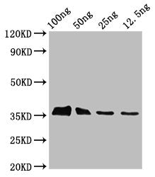 Western Blot Positive WB detected in Recombinant protein All lanes: BLLF3 antibody at 3.3µg/ml Secondary Goat polyclonal to rabbit IgG at 1/50000 dilution Predicted band size: 35 kDa Observed band size: 35 kDa