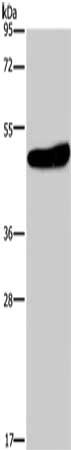 Gel: 8%SDS-PAGE, Lysate: 40 ug, Lane: Mouse brain tissue, Primary antibody: CSB-PA319519(KCNG2 Antibody) at dilution 1/650, Secondary antibody: Goat anti rabbit IgG at 1/8000 dilution, Exposure time: 2 minutes