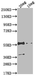 Western Blot Positive WB detected in Recombinant protein All lanes: N antibody at 1:2000 Secondary Goat polyclonal to rabbit IgG at 1/50000 dilution Predicted band size: 45.9 kDa Observed band size: 55 kDa