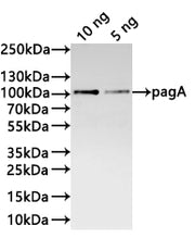 Western Blot Positive WB detected in: recombinant protein All lanes:pagA Antibody at 1:1000 Secondary Goat polyclonal to rabbit IgG at 1/20000 dilution Predicted band size: 89.6 kDa Observed band size: 90 kDa