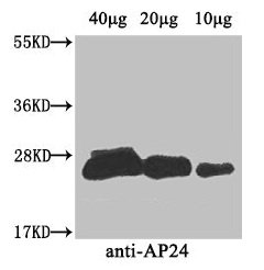 Western Blot Positive WB detected in: Nicotiana tabacum (40µg, 20µg, 10µg) All lanes: AP24 antibody at 3µg/ml Secondary Goat polyclonal to rabbit IgG at 1/50000 dilution Predicted band size: 27 kDa Observed band size: 27 kDa