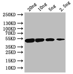Western Blot Positive WB detected in: recombinant protein All lanes: porA Antibody at 1:1000 Secondary Goat polyclonal to rabbit IgG at 1/50000 dilution Predicted band size: 49 kDa Observed band size: 49 kDa