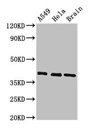 Western Blot Positive WB detected in: A549 whole cell lysate, Hela whole cell lysate, Mouse brain tissue All lanes: HLA-C antibody at 3.4µg/ml Secondary Goat polyclonal to rabbit IgG at 1/50000 dilution Predicted band size: 41 kDa Observed band si...